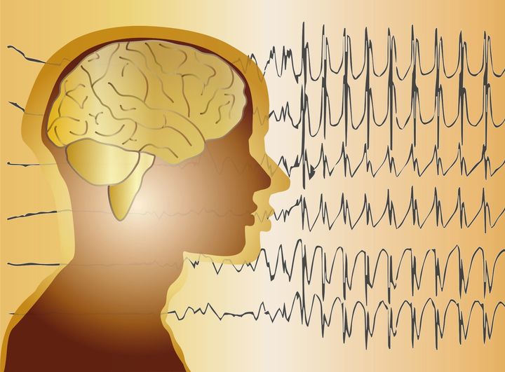 Serviciu nou la Spitalul Județean de Urgență Zalău: electroencefalografie (EEG) pentru adulți