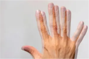 Diplopie-376x251