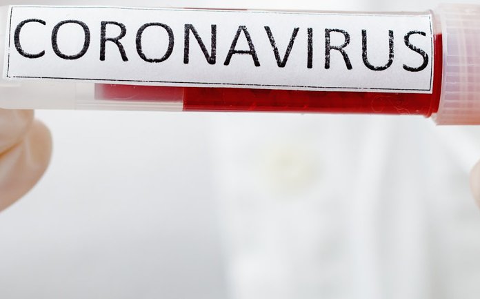 Decizie FINALA: De azi, noile cazuri de coronavirus din Romania, raportate DOAR la ora 13.00