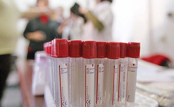 salajul-nu-se-inscrie-la-criza-de-imunoglobulina-din-tara07_59090