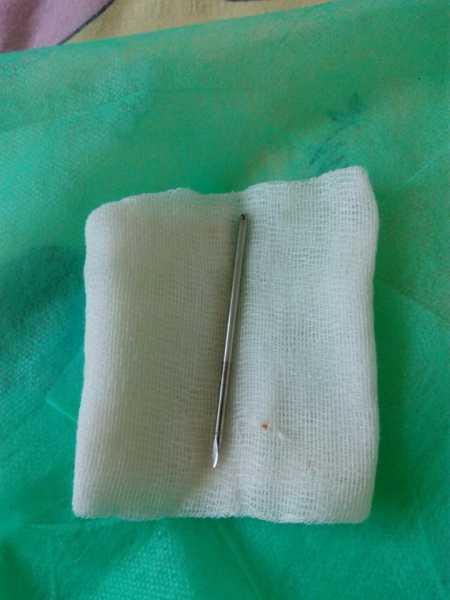 scandal-in-jurul-medicului-horea-jidveianu-coordonatorul-compartimentului-de-chiriurgie-pentru-copii-de-la-spitalul-judetean0_57224