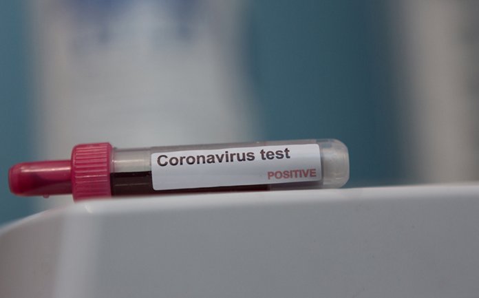 Stoparea extinderii noului coronavirus depinde de fiecare dintre noi!